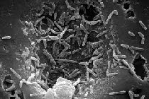 Mycobacterium bovis